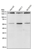 All lanes use the Antibody at 1:2K dilution for 1 hour at room temperature.
