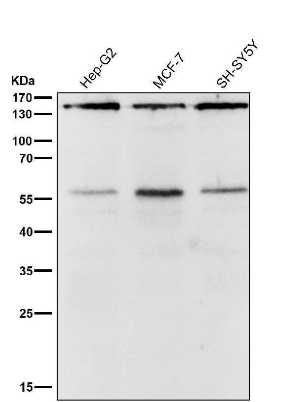 All lanes use the Antibody at 1:2K dilution for 1 hour at room temperature.