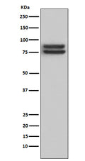 Western blot analysis of FOXP1 expression in Daudi cell lysate.