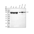 Anti-FOXP1 Rabbit Monoclonal Antibody