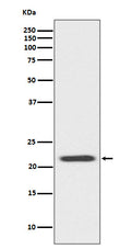Western blot analysis of Bid expression in Jurkat cell lysate.