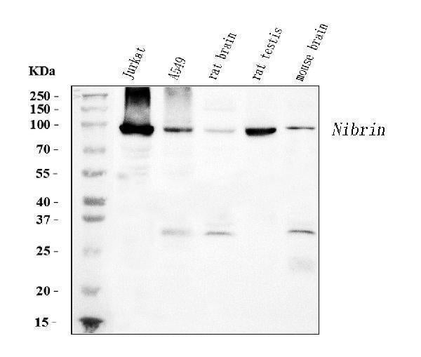 Anti-p95 NBS1 Antibody Picoband® (monoclonal, 5D7A1)