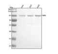 Anti-p95/NBS1 NBN Rabbit Monoclonal Antibody