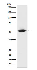 Western blot analysis of MMP1 expression in MMP1 recombinant protein.