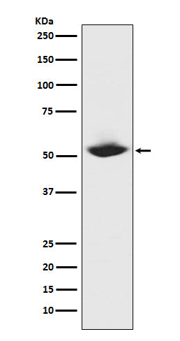 Western blot analysis of MMP1 expression in MMP1 recombinant protein.