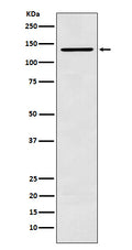 Western blot analysis of CARD11 expression in K562 cell lysate.