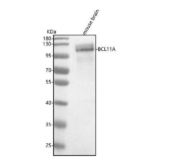 Anti-Ctip1 Monoclonal Antibody