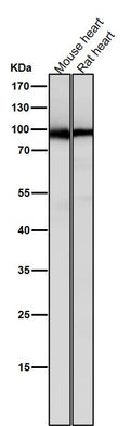 All lanes use the Antibody at 1:5K dilution for 1 hour at room temperature.