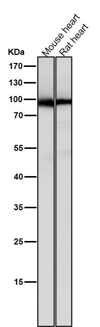 All lanes use the Antibody at 1:5K dilution for 1 hour at room temperature.