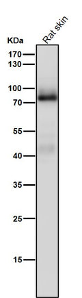 All lanes use the Antibody at 1:5K dilution for 1 hour at room temperature.