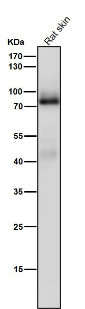 All lanes use the Antibody at 1:5K dilution for 1 hour at room temperature.
