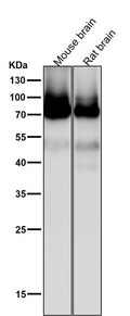 All lanes use the Antibody at 1:2K dilution for 1 hour at room temperature.