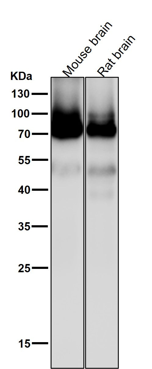 All lanes use the Antibody at 1:2K dilution for 1 hour at room temperature.