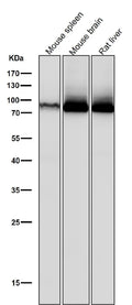 All lanes use the Antibody at 1:5K dilution for 1 hour at room temperature.