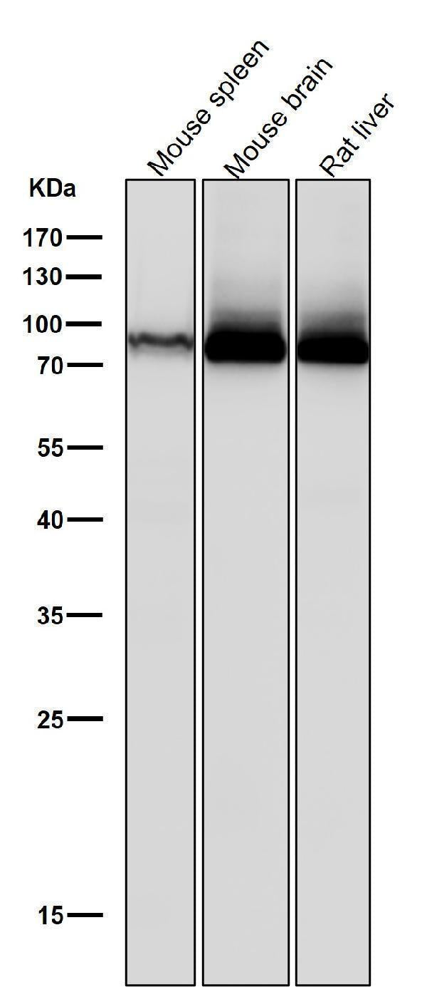 All lanes use the Antibody at 1:5K dilution for 1 hour at room temperature.