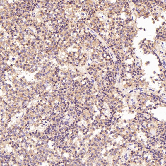 Anti-PKC alpha PRKCA Rabbit Monoclonal Antibody