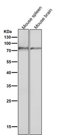 All lanes use the Antibody at 1:3K dilution for 1 hour at room temperature.