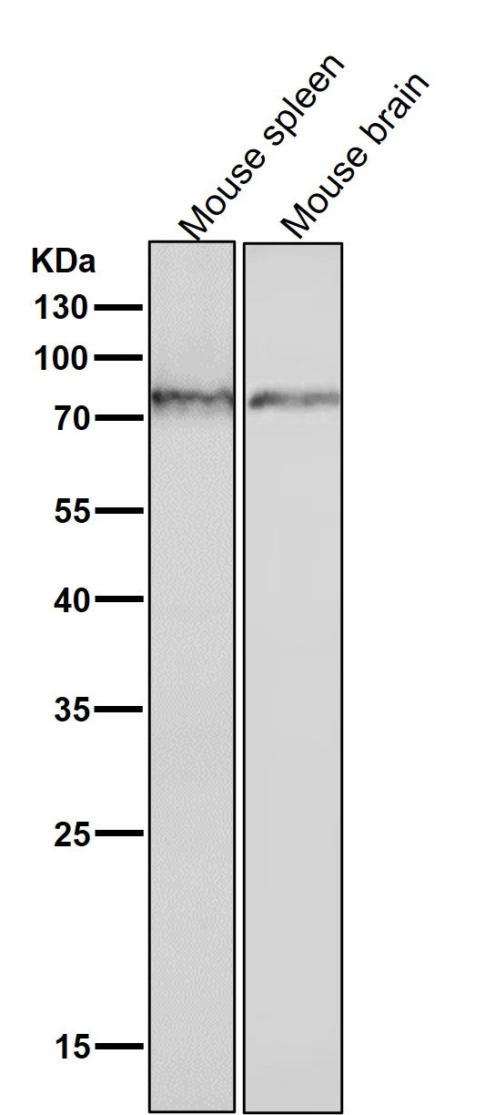 All lanes use the Antibody at 1:3K dilution for 1 hour at room temperature.