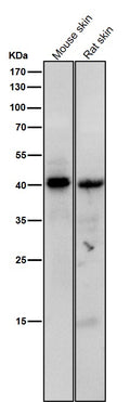 Anti-Phospho-PKA C (Thr197) Rabbit Monoclonal Antibody