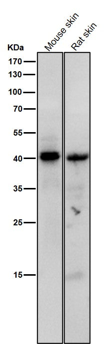 Anti-Phospho-PKA C (Thr197) Rabbit Monoclonal Antibody