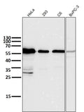 All lanes use the Antibody at 1:6K dilution for 1 hour at room temperature.