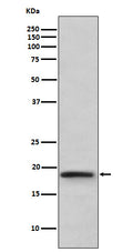 Western blot analysis of TNF beta expression in TNF beta recombinant protein.