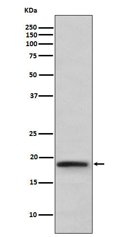 Western blot analysis of TNF beta expression in TNF beta recombinant protein.