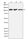 Western blot analysis of DISC1 expression in (1) HeLa cell lysate; (2) RAW264.7 cell lysate; (3) PC-12 cell lysate.