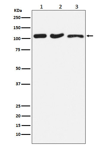 Western blot analysis of DISC1 expression in (1) HeLa cell lysate; (2) RAW264.7 cell lysate; (3) PC-12 cell lysate.