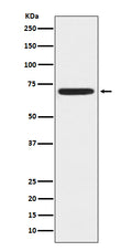 Western blot analysis of ZAP70 expression in Jurkat cell lysate.
