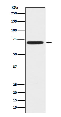 Western blot analysis of ZAP70 expression in Jurkat cell lysate.