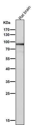 All lanes use the Antibody at 1:1K dilution for 1 hour at room temperature.