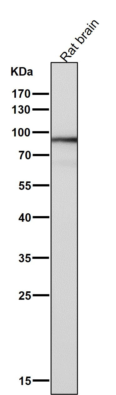 All lanes use the Antibody at 1:1K dilution for 1 hour at room temperature.
