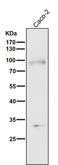 All lanes use the Antibody at 1:2K dilution for 1 hour at room temperature.