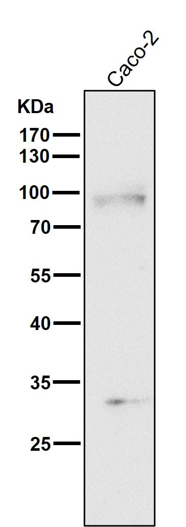 All lanes use the Antibody at 1:2K dilution for 1 hour at room temperature.