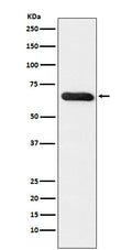 Western blot analysis of RBPJK expression in MCF7 cell lysate.