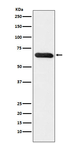 Western blot analysis of RBPJK expression in MCF7 cell lysate.
