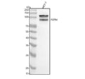 Anti-FGFR4 Rabbit Monoclonal Antibody