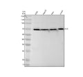 Anti-FUS / TLS Rabbit Monoclonal Antibody
