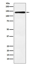 Western blot analysis of Bub1 expression in K562 cell lysate.