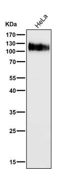 All lanes use the Antibody at 1:6K dilution for 1 hour at room temperature.