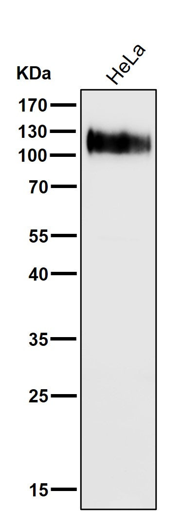 All lanes use the Antibody at 1:6K dilution for 1 hour at room temperature.