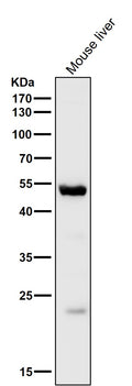 All lanes use the Antibody at 1:3K dilution for 1 hour at room temperature.
