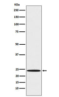 Western blot analysis of Mad2L1 expression in A431 cell lysate.
