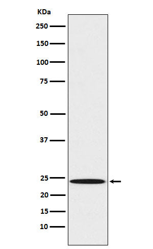 Western blot analysis of Mad2L1 expression in A431 cell lysate.