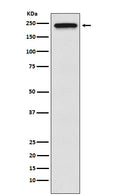 Anti-TRPM7 Monoclonal Antibody
