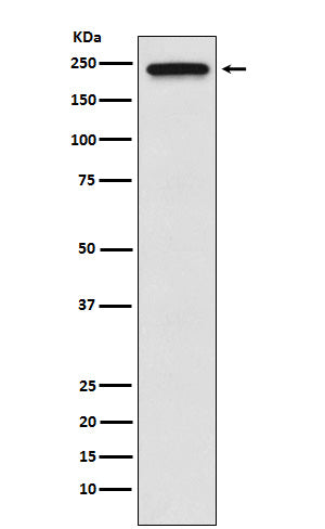 Anti-TRPM7 Monoclonal Antibody
