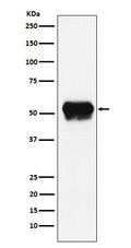 Western blot analysis of Fibrinogen gamma chain expression in Human plasma lysate.