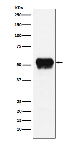 Western blot analysis of Fibrinogen gamma chain expression in Human plasma lysate.