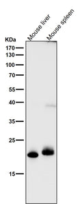 All lanes use the Antibody at 1:1K dilution for 1 hour at room temperature.